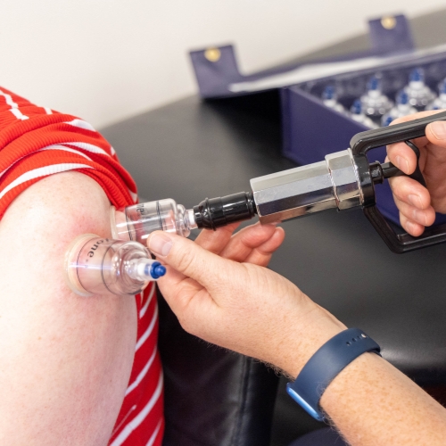 IASTM-graston-and-cupping-1-Aspen-Ridge-Physical-Therapy-Syracuse-Layton-UT